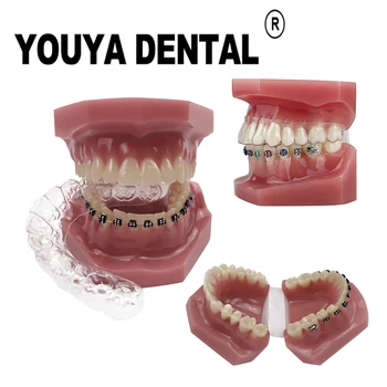 Стоматологичен Невидим скоба Ортодонтическая модел за практикуване на зъбен техника, обучение, комуникация с пациента, Модел на зъбите